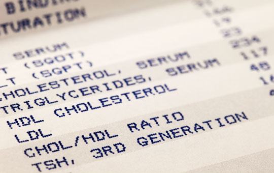 cholesterol_test
