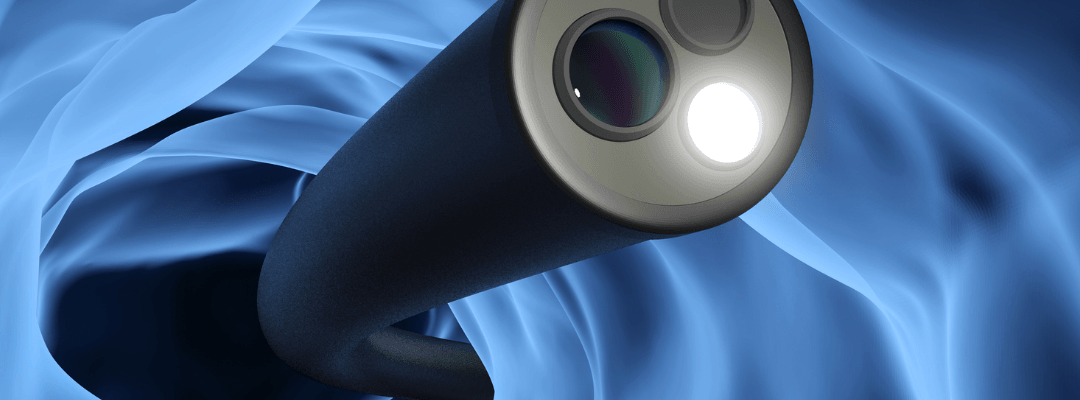 colonoscopy research